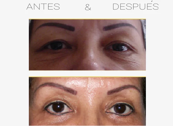 clinicas otoplastia cali Clinica estetica de Cali