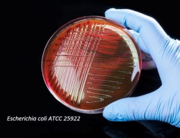 analisis intolerancia alimentaria cali AV-LAB Microbiología S.A.S.