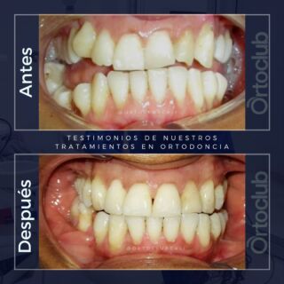clinicas ortodoncia cali OrtoClub